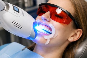 Entdecken Sie unsere kosmetische Zahnaufhellung in Krefeld. Wählen Sie zwischen Smile Start ab 150 € und Smile Intense für 180 €.